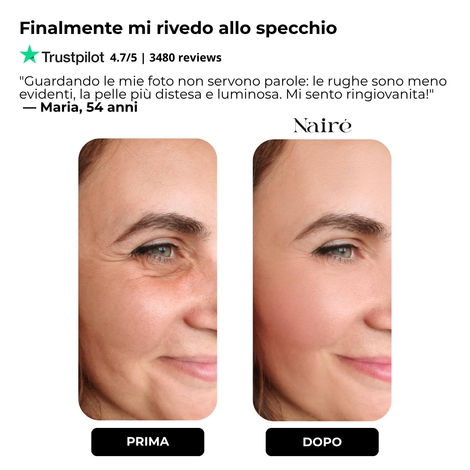 Nairè™ Micro-Needling Esosomi Vegetali